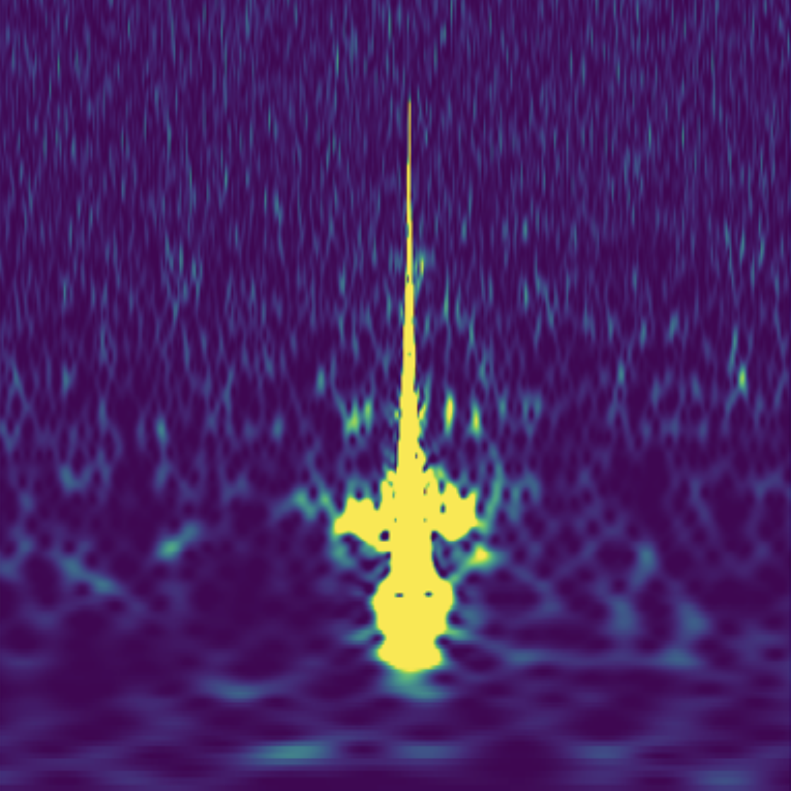 LIGO glitches